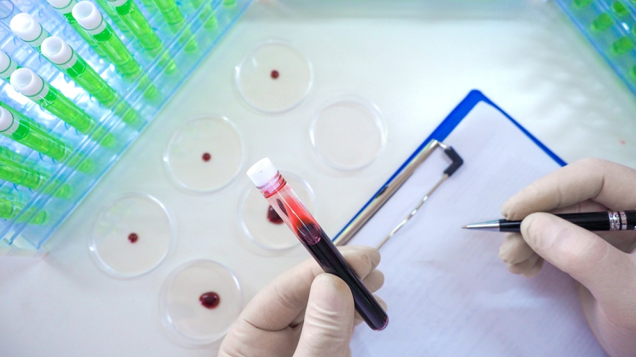 CDC: 41 άτομα στις ΗΠΑ υπό παρακολούθηση για χανταϊό – Σύσταση για απομόνωση 42 ημερών