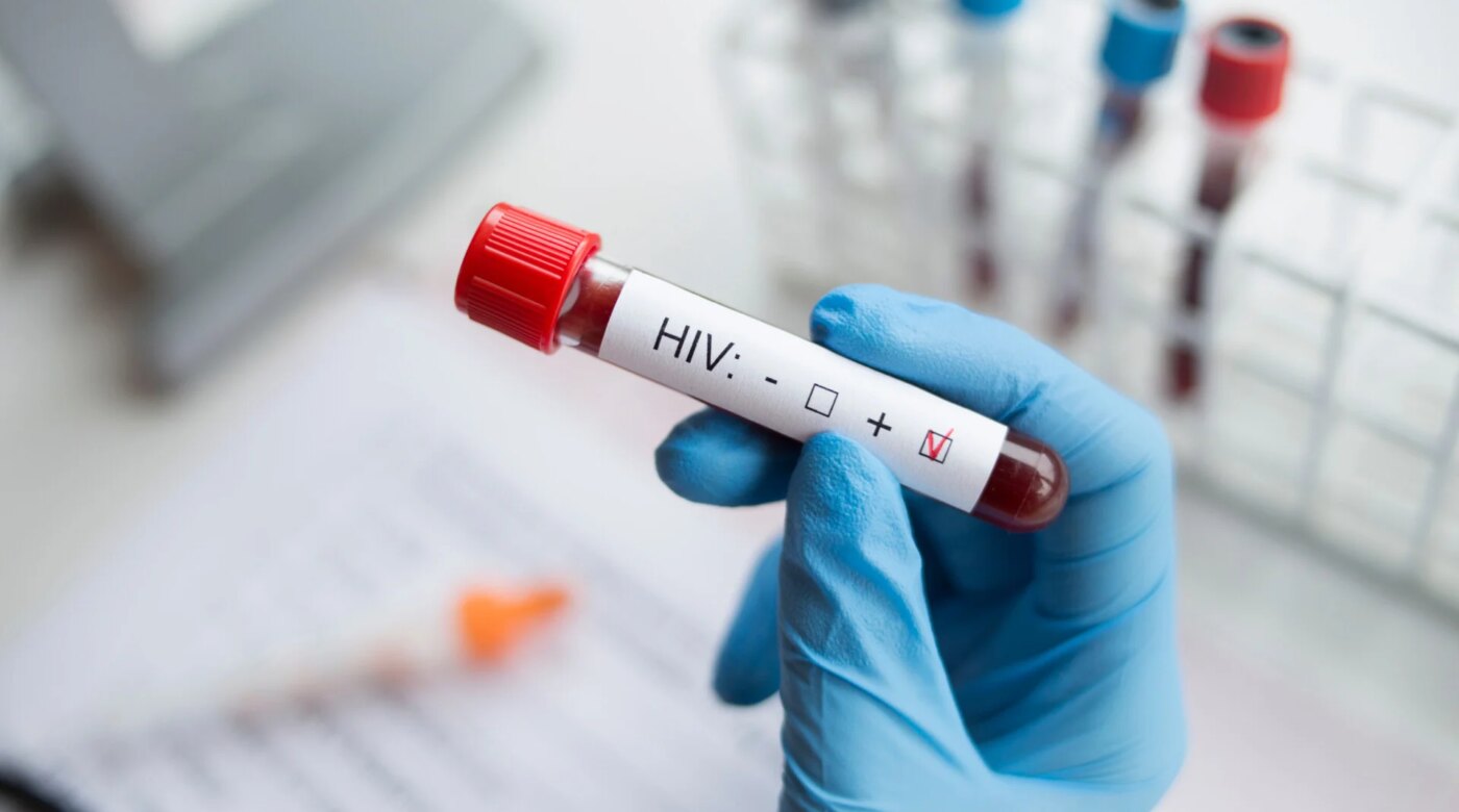AIDS: Οι επιστήμονες μαθαίνουν να ελέγχουν τον HIV χωρίς φάρμακα