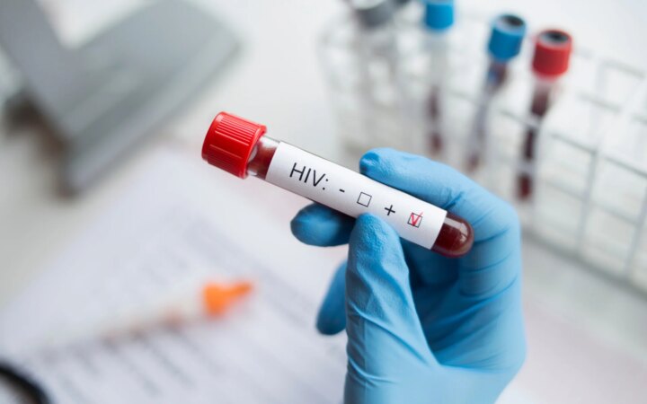 AIDS: Οι επιστήμονες μαθαίνουν να ελέγχουν τον HIV χωρίς φάρμακα