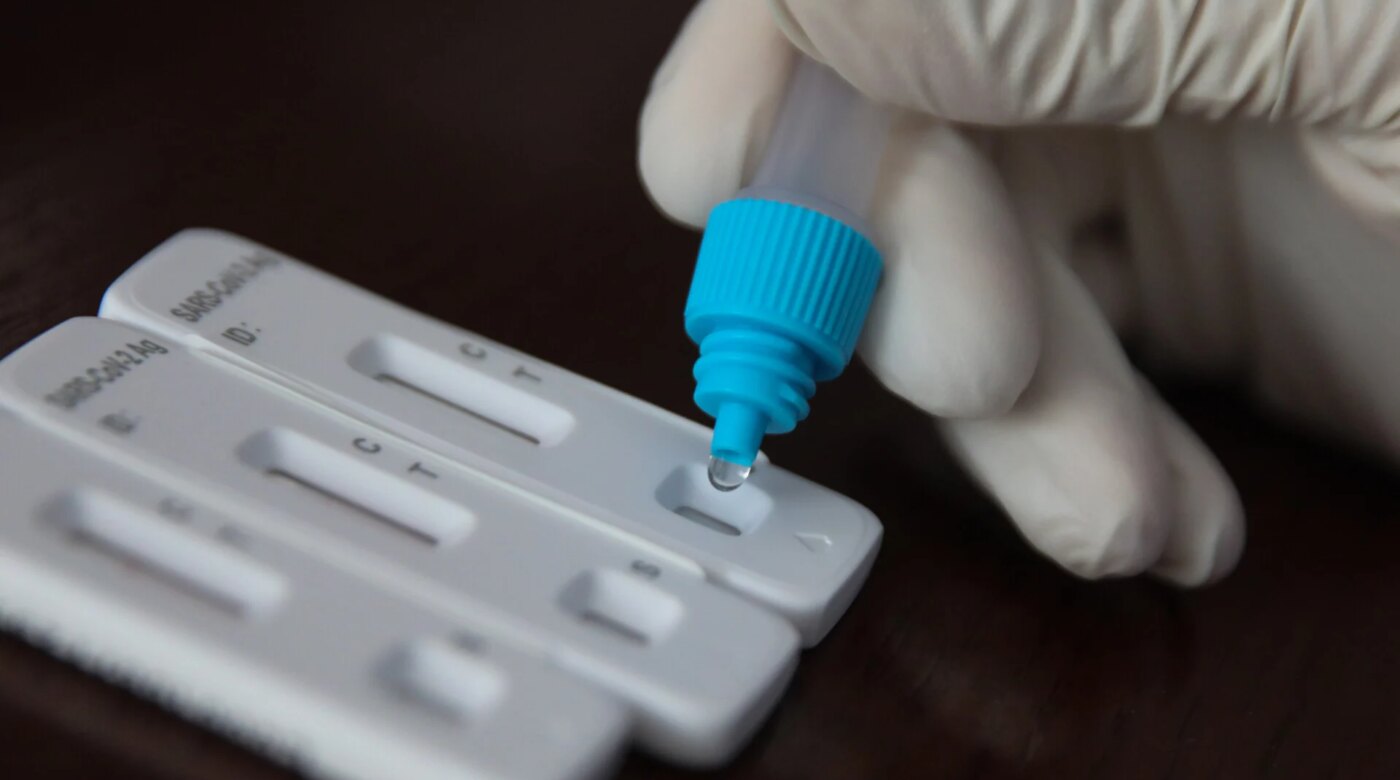 Ανοδική τάση στις εισαγωγές από COVID-19 και γρίπη
